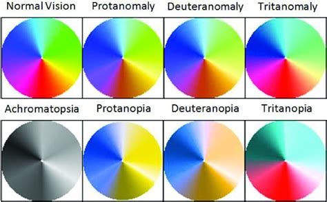 Types of Color Blindness 